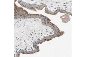 Immunohistochemical staining of human skeletal muscle with XYLT1 polyclonal antibody  shows moderate cytoplasmic positivity at 1:20-1:50 dilution. (XYLT1 anticorps)