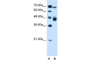 WB Suggested Anti-NR2F6 Antibody Titration:  0. (NR2F6 anticorps  (N-Term))