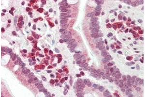 Human Small Intestine: Formalin-Fixed, Paraffin-Embedded (FFPE)