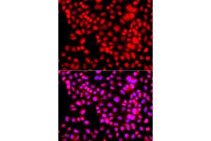 Immunofluorescence analysis of A549 cell using THAP1 antibody. (THAP1 anticorps)