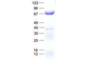 Validation with Western Blot