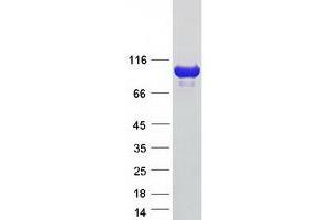 Validation with Western Blot