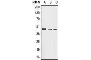 Western blot analysis of c-Jun expression in HeLa (A), mouse kidney (B), PC12 (C) whole cell lysates. (C-JUN anticorps  (Center))