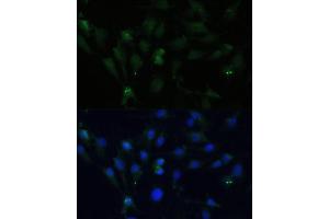 Immunofluorescence analysis of C6 cells using ZWINT Polyclonal Antibody (ABIN6128944, ABIN6150552, ABIN6150554 and ABIN6221938) at dilution of 1:100 (40x lens). (ZWINT anticorps  (AA 1-277))