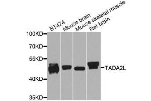Western blot analysis of extracts of various cell lines, using TADA2A antibody. (TADA2L anticorps  (AA 1-443))