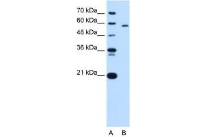 PKLR antibody used at 5 ug/ml to detect target protein. (PKLR anticorps  (N-Term))