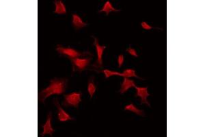 ABIN6274303 staining COLO205 by IF/ICC.