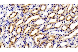 Detection of GSTM1 in Rat Kidney Tissue using Polyclonal Antibody to Glutathione S Transferase Mu 1 (GSTM1)