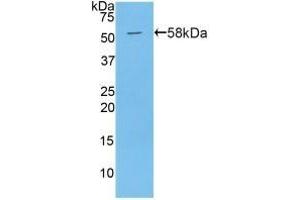 Detection of Recombinant PAPPA, Mouse using Polyclonal Antibody to Pregnancy Associated Plasma Protein A (PAPPA)