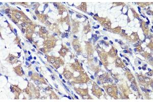 Immunohistochemistry of paraffin-embedded Human stomach using UBL3 Polyclonal Antibody at dilution of 1:100 (40x lens). (UBL3 anticorps)