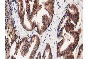 Image no. 5 for anti-Glutathione S-Transferase theta 2 (GSTT2) antibody (ABIN1498554)