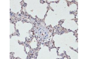 Immunohistochemistry of paraffin-embedded Rat lung using Phospho-Jak2(Y1007/1008) Polyclonal Antibody at dilution of 1:200 (40x lens). (JAK2 anticorps  (pTyr1007, pTyr1008))