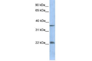 WB Suggested Anti-RYBP Antibody Titration:  0. (RYBP anticorps  (C-Term))