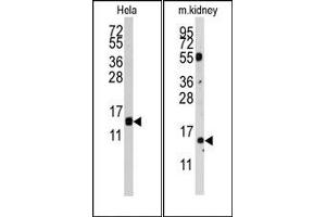 Image no. 1 for anti-Cytidine Deaminase (CDA) (AA 59-89) antibody (ABIN358053) (CDA anticorps  (AA 59-89))