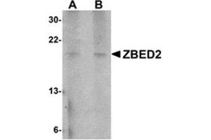 Western blot analysis of ZBED2 in A549 cell lysate with this product at (A) 1 and (B) 2 μg/ml. (ZBED2 anticorps  (N-Term))