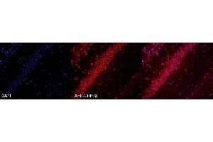 Immunohistochemistry analysis using Rabbit Anti-GRP78 Polyclonal Antibody (ABIN2486757). (GRP78 anticorps  (APC))