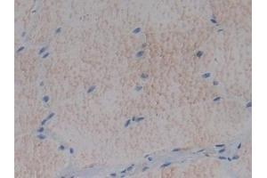 Detection of FMOD in Rat Skeletal muscle Tissue using Polyclonal Antibody to Fibromodulin (FMOD)