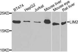 Western blot analysis of extracts of various cell lines, using LIM2 antibody. (LIM2 anticorps)