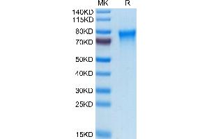Human TREML2/TLT-2 on Tris-Bis PAGE under reduced condition. (TREML2 Protein (AA 19-268) (His tag))