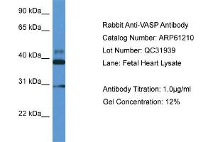 Western Blotting (WB) image for anti-Vasodilator-Stimulated phosphoprotein (VASP) (Middle Region) antibody (ABIN2774308) (VASP anticorps  (Middle Region))