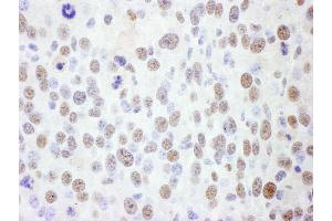 Immunohistochemistry (IHC) image for anti-Structural Maintenance of Chromosomes 1A (SMC1A) (AA 1183-1233) antibody (ABIN7454968) (SMC1A anticorps  (AA 1183-1233))