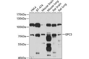 Western blot analysis of extracts of various cell lines, using GPC5 antibody (ABIN6127989, ABIN6141313, ABIN6141314 and ABIN6214656) at 1:1000 dilution. (GPC5 anticorps  (AA 320-550))