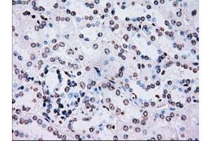 Image no. 10 for anti-Polo-Like Kinase 1 (PLK1) antibody (ABIN1500282)