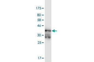 Western Blot detection against Immunogen (37. (PRKAR2A anticorps  (AA 1-105))