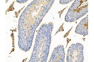 Phospho-eIF4E (Thr55) Antibody at 1/100 staining Mouse testis tissue by IHC-P. (EIF4E anticorps  (pThr55))