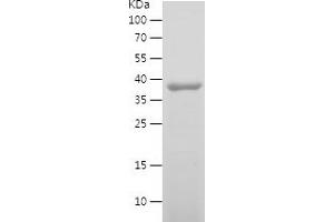 Western Blotting (WB) image for Neurotrophic Tyrosine Kinase, Receptor, Type 2 (NTRK2) (AA 32-205) protein (His-IF2DI Tag) (ABIN7124157)