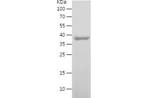 Western Blotting (WB) image for Neurotrophic Tyrosine Kinase, Receptor, Type 2 (NTRK2) (AA 32-205) protein (His-IF2DI Tag) (ABIN7124157) (TRKB Protein (AA 32-205) (His-IF2DI Tag))