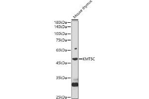Western blot analysis of extracts of Mouse thymus, using KMT5C antibody (ABIN7270649) at 1:1000 dilution. (SUV420H2/KMT5C anticorps  (AA 100-200))