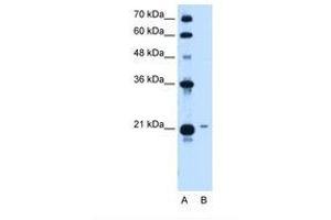 Image no. 2 for anti-T-Complex 10 (TCP10) (AA 109-158) antibody (ABIN321002) (TCP10 anticorps  (AA 109-158))