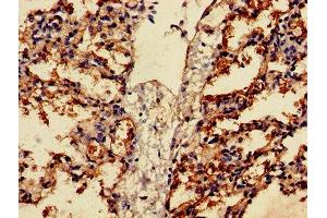 Immunohistochemistry of paraffin-embedded human lung tissue using ABIN7153163 at dilution of 1:100 (FFAR2 anticorps  (AA 277-330))
