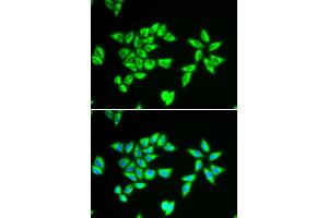 Immunofluorescence analysis of MCF-7 cells using PTRH2 antibody (ABIN5973864). (PTRH2 anticorps)