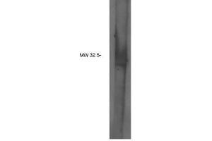 Image no. 1 for anti-Phosphatidic Acid Phosphatase Type 2C (PPAP2C) antibody (ABIN4620344)