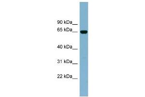 WB Suggested Anti-IL22RA1 Antibody Titration:  0. (IL22 Receptor alpha 1 anticorps  (Middle Region))