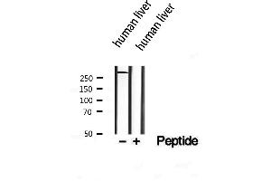 Western blot analysis of extracts from Hnuman liver, using SPG11 antibody.