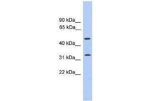 Western Blot showing FAM79B antibody used at a concentration of 1-2 ug/ml to detect its target protein. (TPRG1 anticorps  (C-Term))