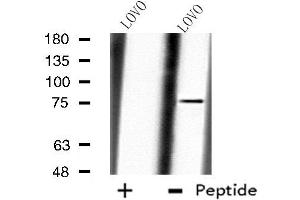 Western blot analysis of extracts from LOVO cells, using CAPN10 antibody. (CAPN10 anticorps  (N-Term))