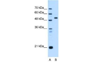 ST14 antibody used at 0. (ST14 anticorps)