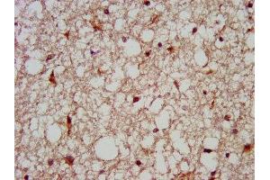 IHC image of ABIN7159209 diluted at 1:200 and staining in paraffin-embedded human brain tissue performed on a Leica BondTM system.