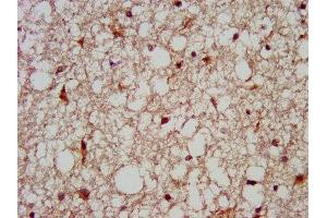 IHC image of ABIN7159209 diluted at 1:200 and staining in paraffin-embedded human brain tissue performed on a Leica BondTM system. (MC3R anticorps  (AA 38-74))