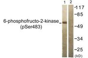 Western blot analysis of extracts from 293 cells treated with Heat shock, using PFKFB2 (Phospho-Ser483) Antibody. (PFKFB2 anticorps  (pSer483))