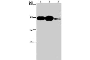 Western Blot analysis of Mouse stomach tissue, 293T and Jurkat cell using PLA2G4B Polyclonal Antibody at dilution of 1:1400 (PLA2G4B anticorps)