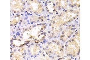Immunohistochemistry of paraffin-embedded Human kidney using PSMC6 Polyclonal Antibody at dilution of 1:100 (40x lens). (PSMC6 anticorps)