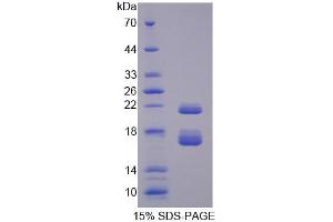 SDS-PAGE analysis of Mouse CBY1 Protein. (CBY1/PGEA1 Protéine)