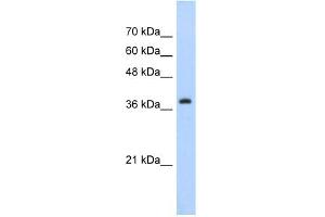 WB Suggested Anti-CBX6 Antibody Titration:  5. (CBX6 anticorps  (C-Term))