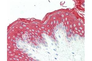 Anti-KRT10 / CK10 / Cytokeratin 10 antibody IHC staining of human skin.