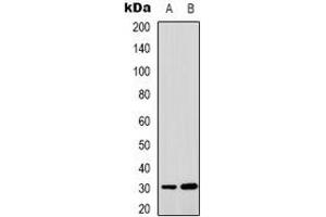 Western blot analysis of MTIF3 expression in HepG2 (A), HUVEC (B) whole cell lysates. (MTIF3 anticorps)